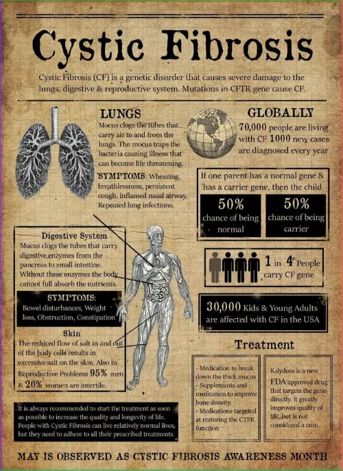 Cystic Fibrosis infographic