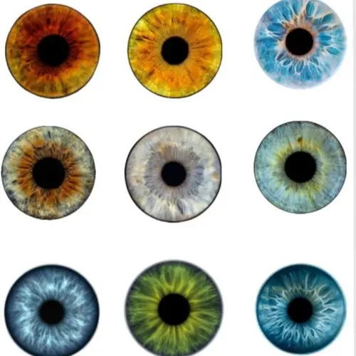 Eye variation