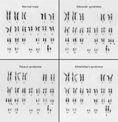 Different karyotypes