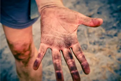 Hands are a line of defence, that help remove dirt