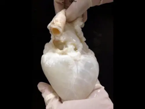 A heart with no blood