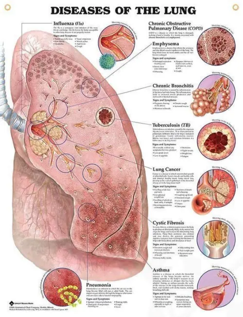 Lung diseases