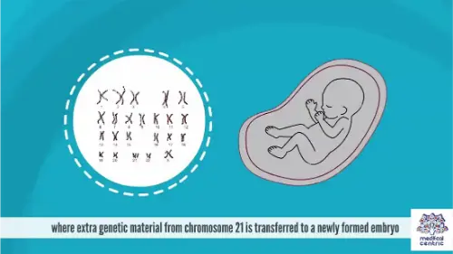 Watch this video from Medical Centric on YouTube