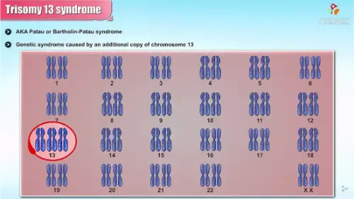 Watch this video from Dr Bhanu Prakash on YouTube